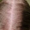 CALECIM Professional Hair Serum Plaukų procedūra - Image 2