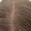 CALECIM Professional Hair Serum Plaukų procedūra - Image 3